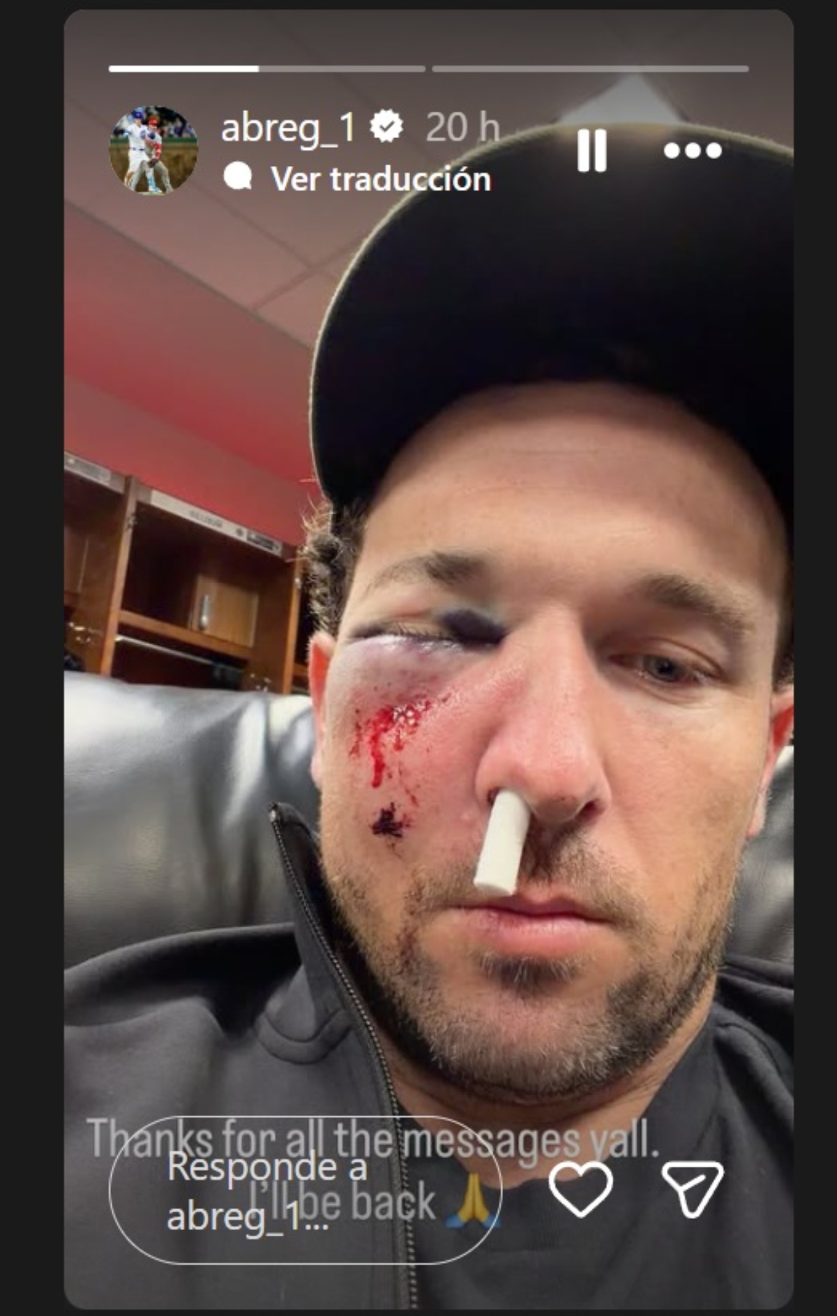 Alex Bregman recibe pelotazo en el rostro
