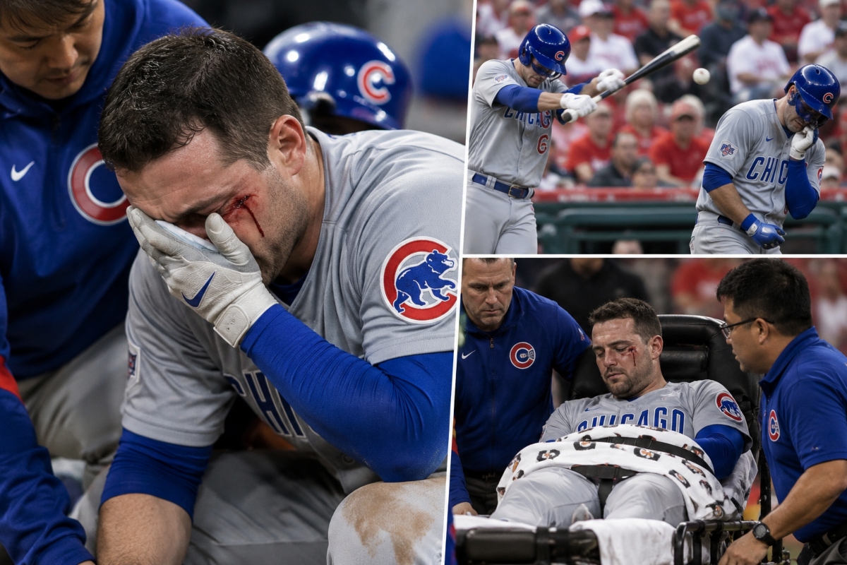 Alex Bregman recibe brutal pelotazo en el rostro y enciende las alarmas de los Cubs