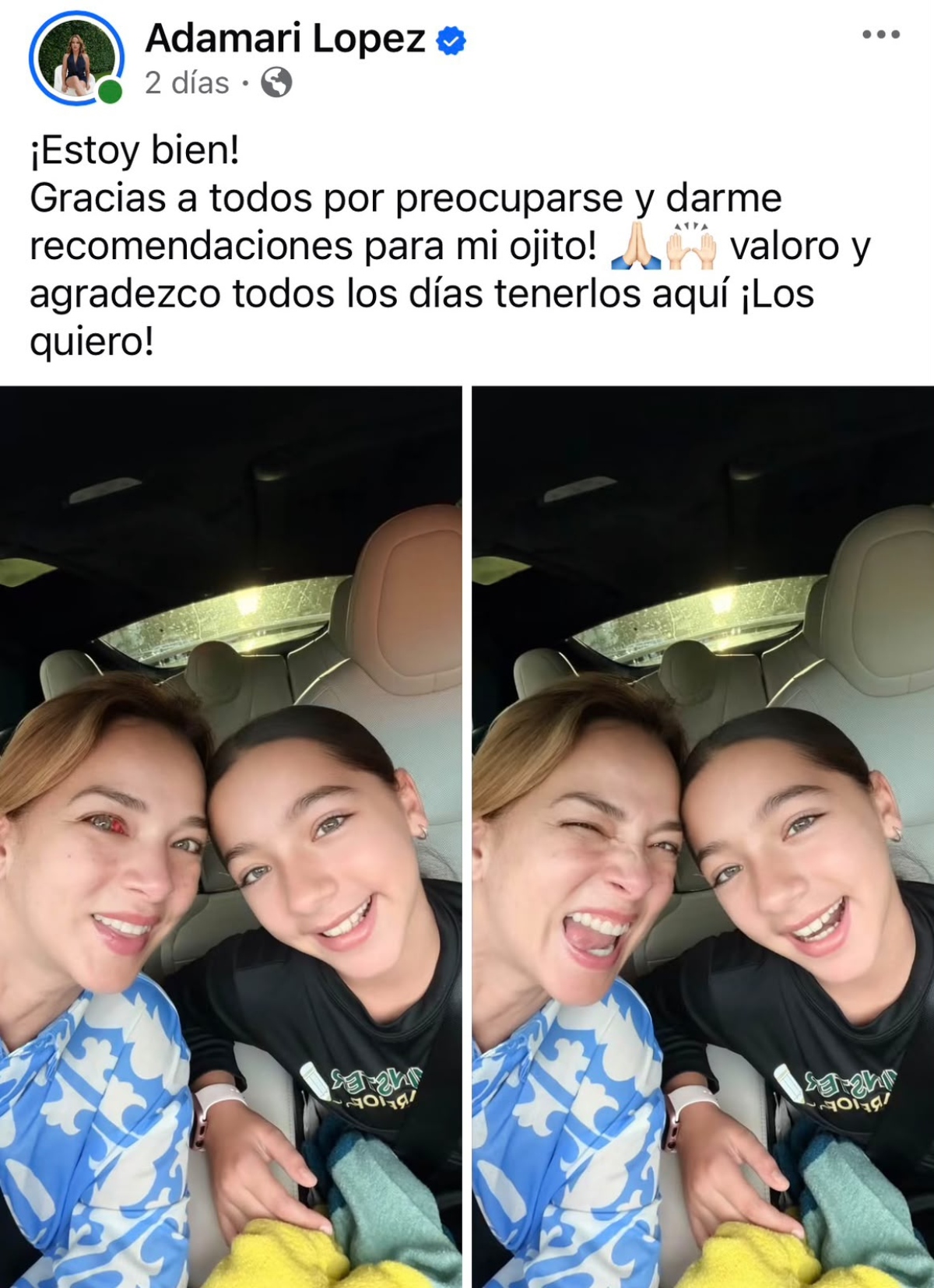 Adamari López aparece con un ojo rojo y causa preocupación